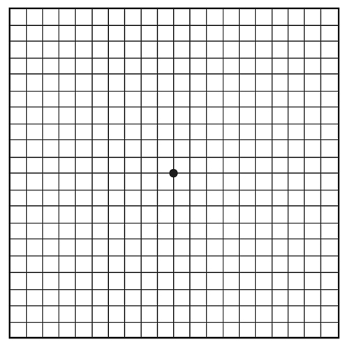Grilla de Amsler con líneas negras que forman cuadrados pequeños y un punto negro en el centro.