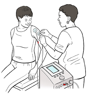 Técnico colocando los electrodos conectados a una máquina de ENET en el brazo de una mujer.