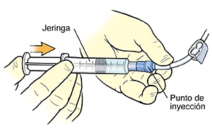Imagen de cerca de un par de manos utilizando una jeringa para inyectar la solución en el tapón del punto de inyección del catéter.