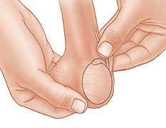 Primer plano de manos que revisan los conductos deferentes durante un autoexamen testicular.